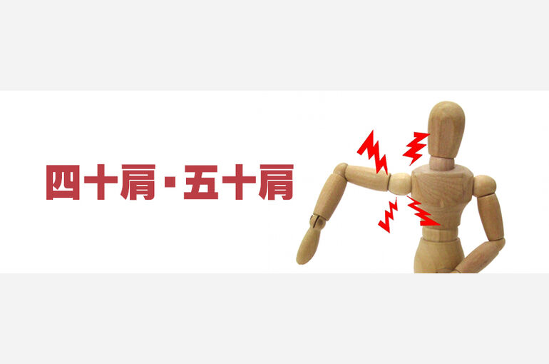 四十肩・五十肩の画像